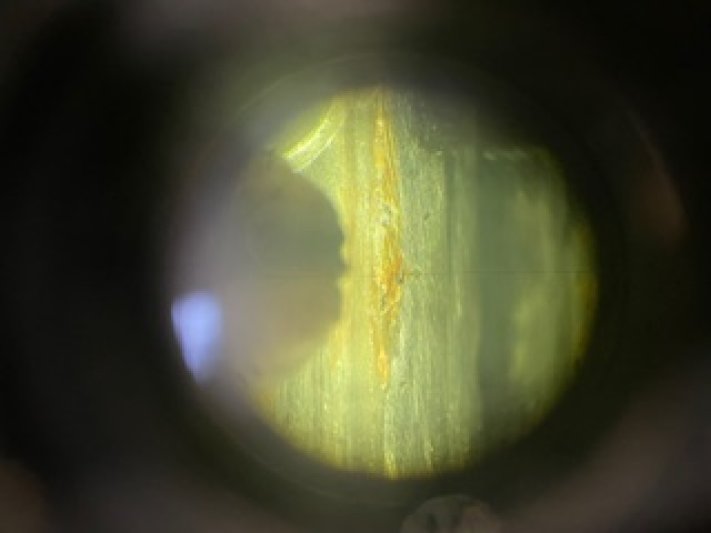 Laser Weld and Repair 